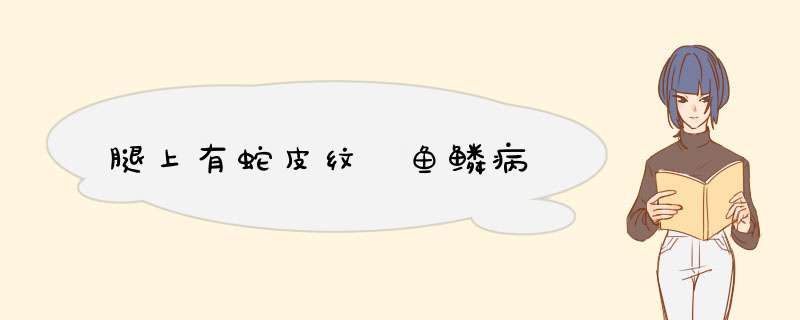 腿上有蛇皮纹 鱼鳞病